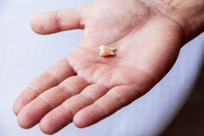 吉夢と思われる歯が抜ける夢を見ました。人に話したほうがいいですか? 吉夢と思われる歯が抜ける夢を見ました。人に話したほうがいいですか?